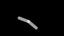 Arm